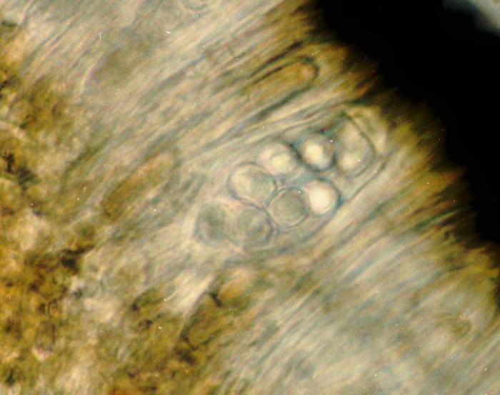 Photograph of an ascus from an apothecium of Lecidella stigmatea taken through a compound microscope (x1000), showing 8, simple, hyaline spores per ascus (spores measure 8 x 6 microns). / © Ed Uebel