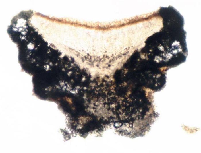 Photograph of a cross section of an apothecium from Lecanora pulicaris taken through a compound microscope (x100), showing large crystals in the amphithecium. / © Ed Uebel