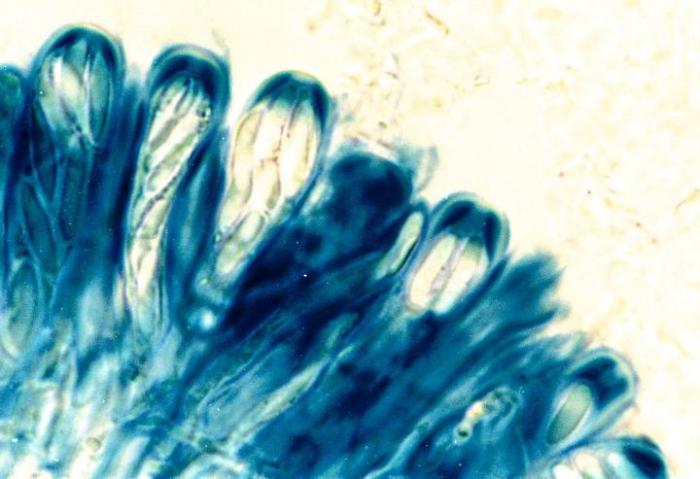 Photograph of a cross section of an apothecium, through a compound microscope (x1000), showing asci stained with iodine (Lugol