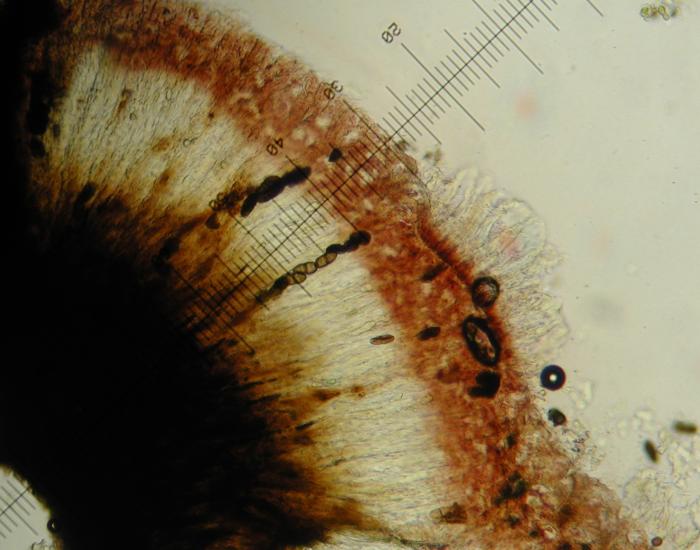 Rhizocarpon badioatrum (Flörke ex Spreng.) Th. Fr., 1874
