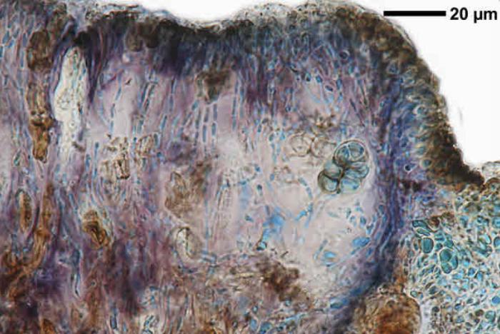 Rhizocarpon badioatrum (Flörke ex Spreng.) Th. Fr., 1874