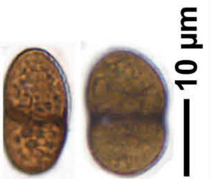 Rhizocarpon badioatrum (Flörke ex Spreng.) Th. Fr., 1874