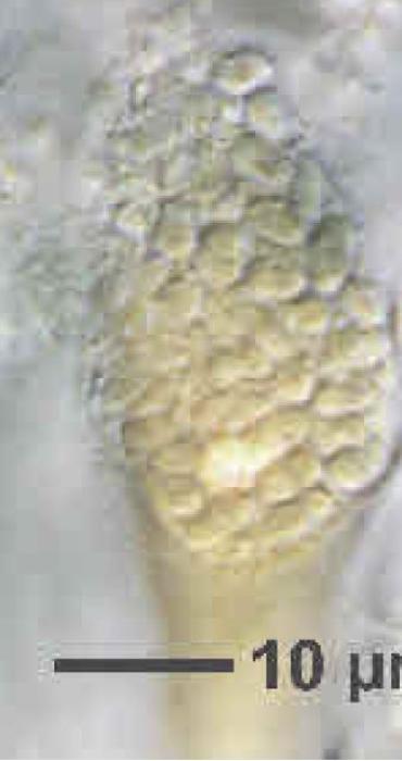 Peltula euploca (Ach.) Poelt ex Ozenda & Clauzade, 1970