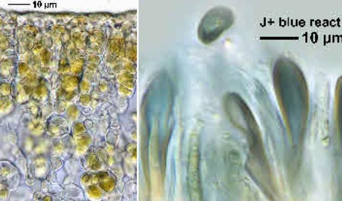 Peltula euploca (Ach.) Poelt ex Ozenda & Clauzade, 1970