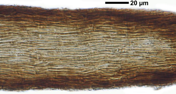 Chaenotheca furfuracea (L.) Tibell, 1984