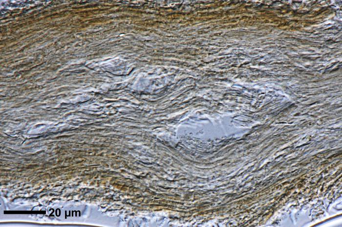 Chaenotheca furfuracea (L.) Tibell, 1984