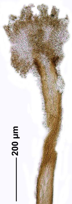Chaenotheca furfuracea (L.) Tibell, 1984