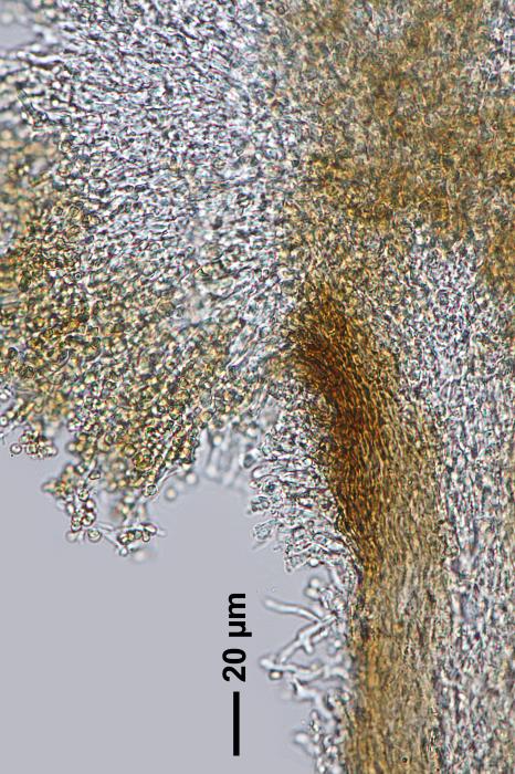 Chaenotheca furfuracea (L.) Tibell, 1984