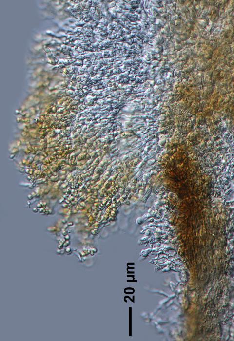 Chaenotheca furfuracea (L.) Tibell, 1984