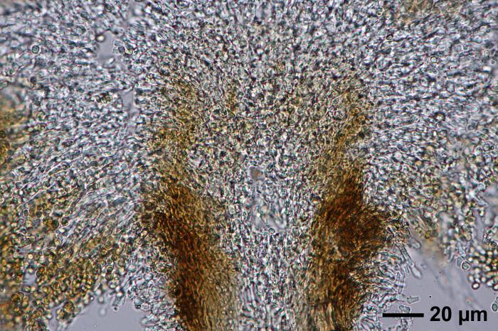 Chaenotheca furfuracea (L.) Tibell, 1984