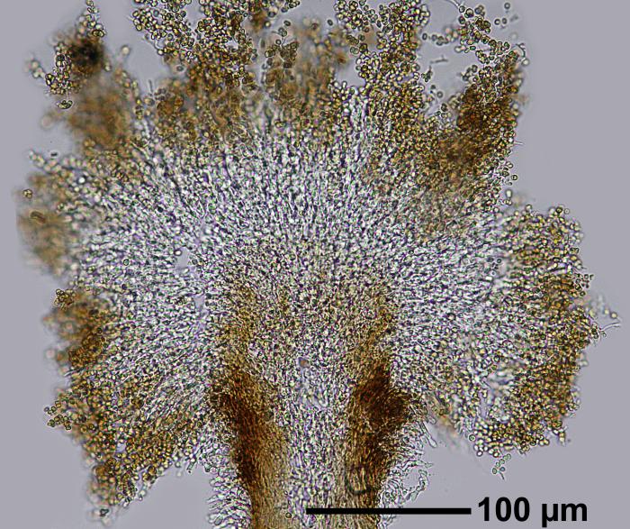 Chaenotheca furfuracea (L.) Tibell, 1984