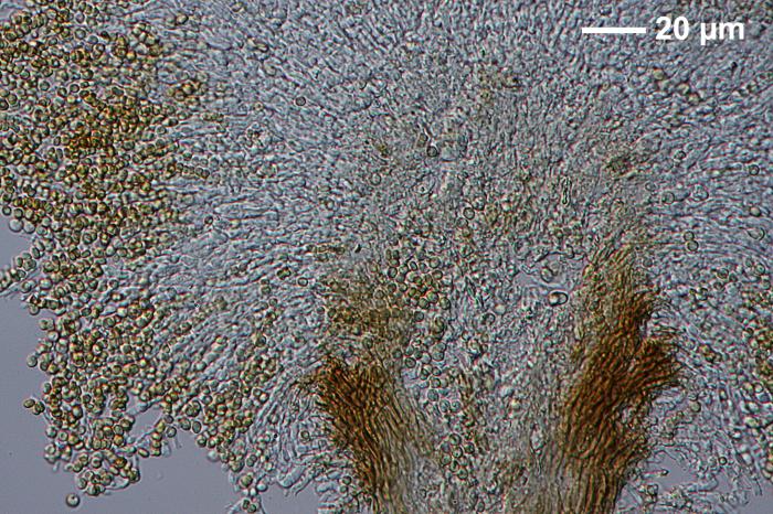 Chaenotheca furfuracea (L.) Tibell, 1984