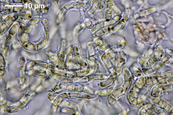 Chaenotheca furfuracea (L.) Tibell, 1984