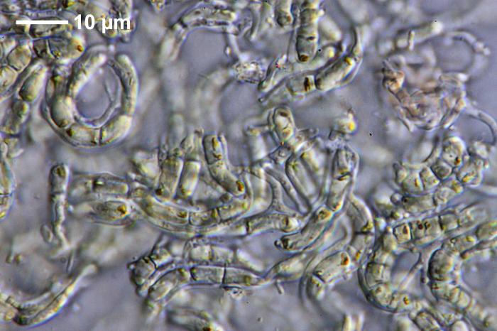 Chaenotheca furfuracea (L.) Tibell, 1984