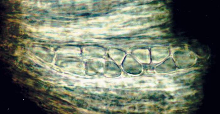 Rhizocarpon hochstetteri (Körb.) Vain., 1922