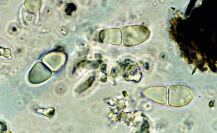 Rhizocarpon hochstetteri (Körb.) Vain., 1922