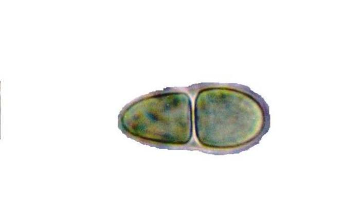 Rhizocarpon hochstetteri (Körb.) Vain., 1922
