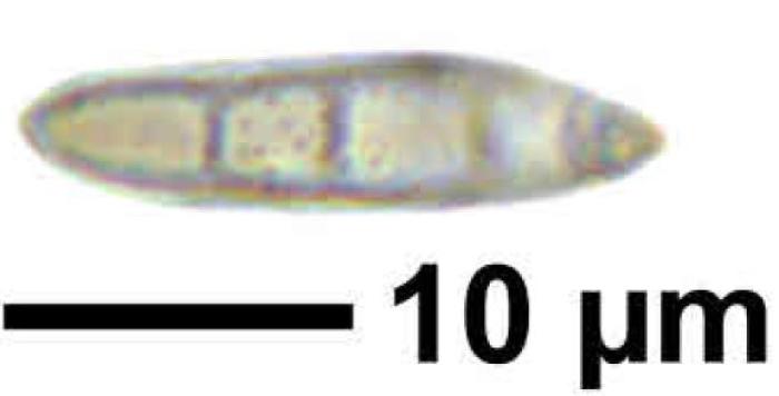 Unusual form / © Felix Schumm