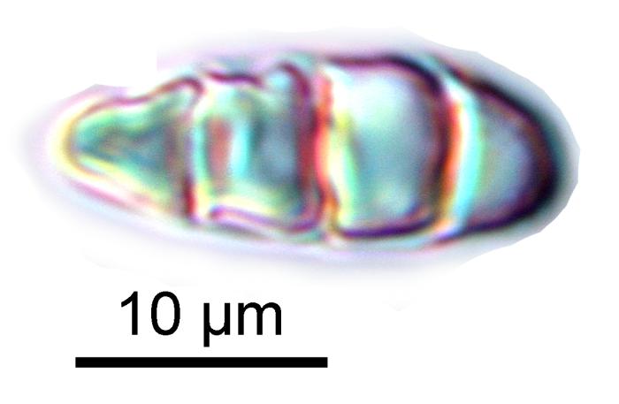 Rhizocarpon reductum Th. Fr., 1874