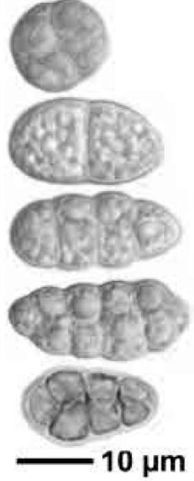 Rhizocarpon reductum Th. Fr., 1874