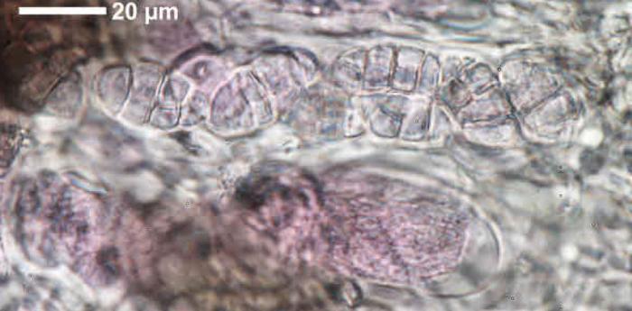 Rhizocarpon reductum Th. Fr., 1874