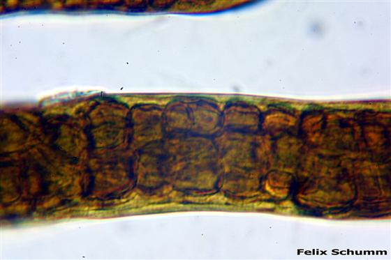 Ephebe lanata (L.) Vain.