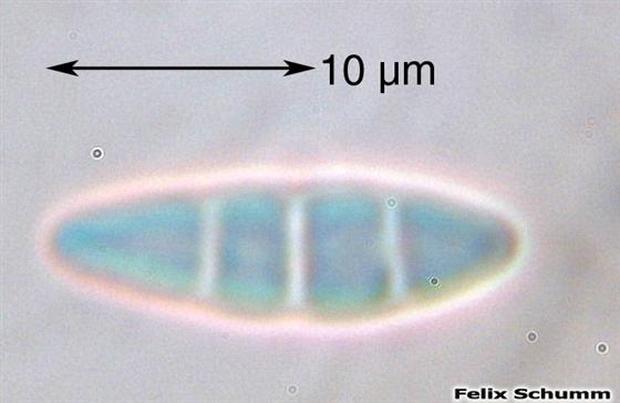 Toniniopsis aromatica (Sm.) Kistenich, Timdal, Bendiksby & S. Ekman, 2018