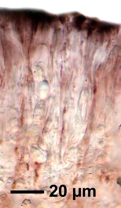 Tephromela atra (Huds.) Hafellner, 1983