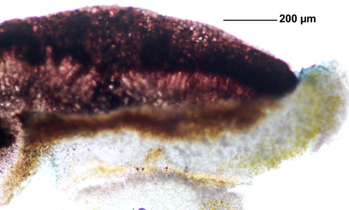 Tephromela atra (Huds.) Hafellner, 1983