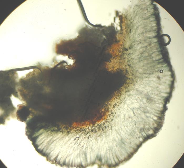 Mycoblastus sanguinarius (L.) Norman, 1853