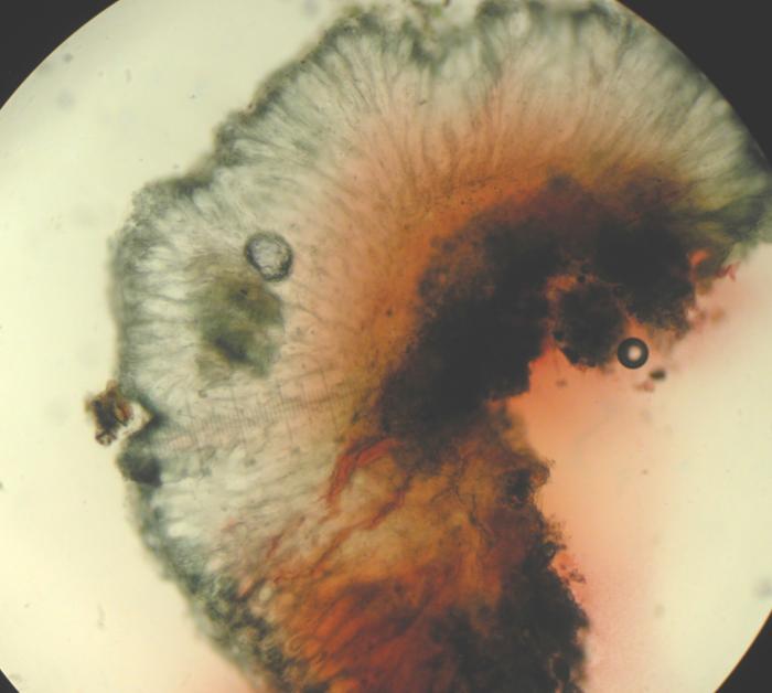 Mycoblastus sanguinarius (L.) Norman, 1853