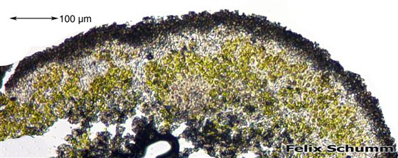 Placopsis gelida (L.) Linds., 1866