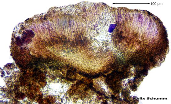Placynthiella icmalea (Ach.) Coppins & P. James, 1984