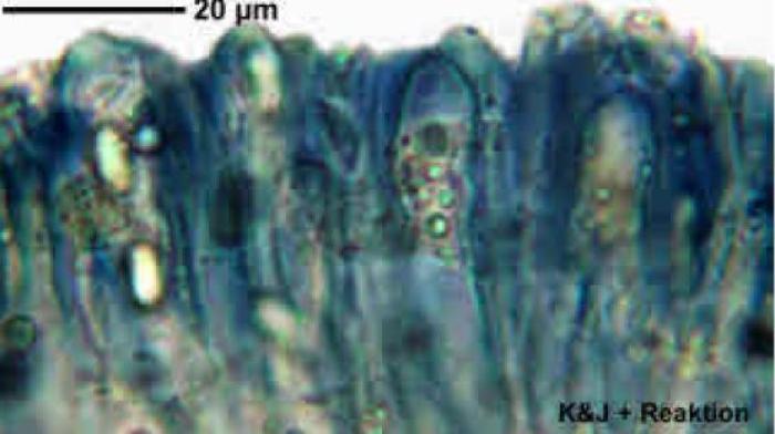 Placynthiella icmalea (Ach.) Coppins & P. James, 1984