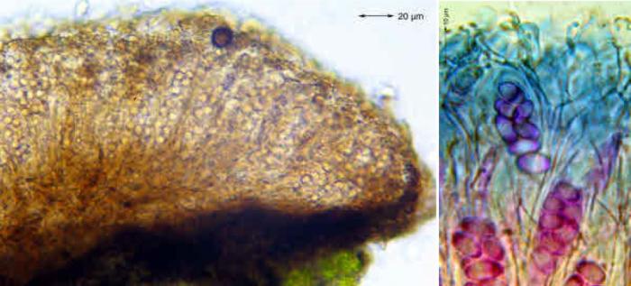 Placynthiella icmalea (Ach.) Coppins & P. James, 1984