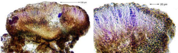 Placynthiella icmalea (Ach.) Coppins & P. James, 1984