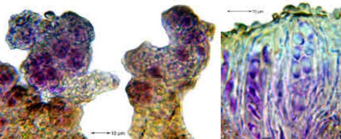 Placynthiella icmalea (Ach.) Coppins & P. James, 1984