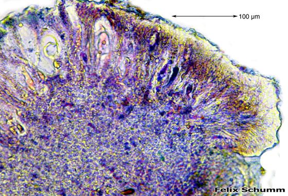 Mycoblastus affinis (Schaer.) T. Schauer, 1964