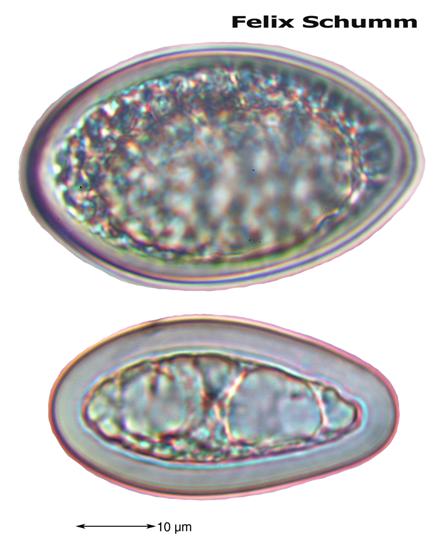 Mycoblastus affinis (Schaer.) T. Schauer, 1964