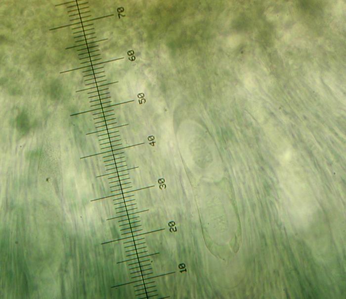 Mycoblastus affinis (Schaer.) T. Schauer, 1964