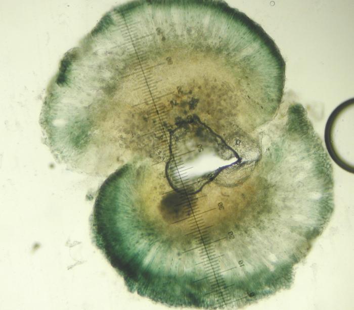 Mycoblastus affinis (Schaer.) T. Schauer, 1964