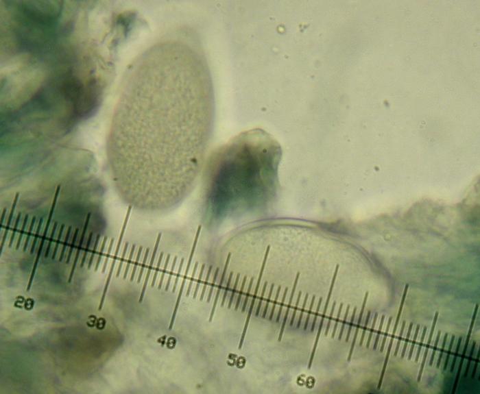 Mycoblastus affinis (Schaer.) T. Schauer, 1964