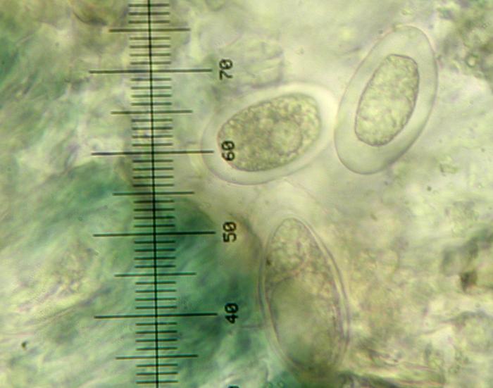 Mycoblastus affinis (Schaer.) T. Schauer, 1964