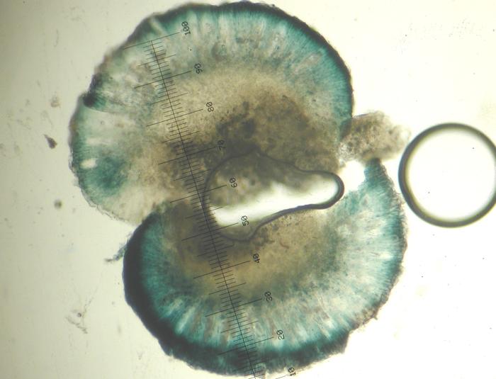 Mycoblastus affinis (Schaer.) T. Schauer, 1964