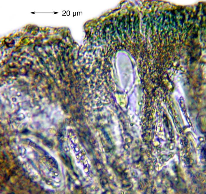 Mycoblastus affinis (Schaer.) T. Schauer, 1964
