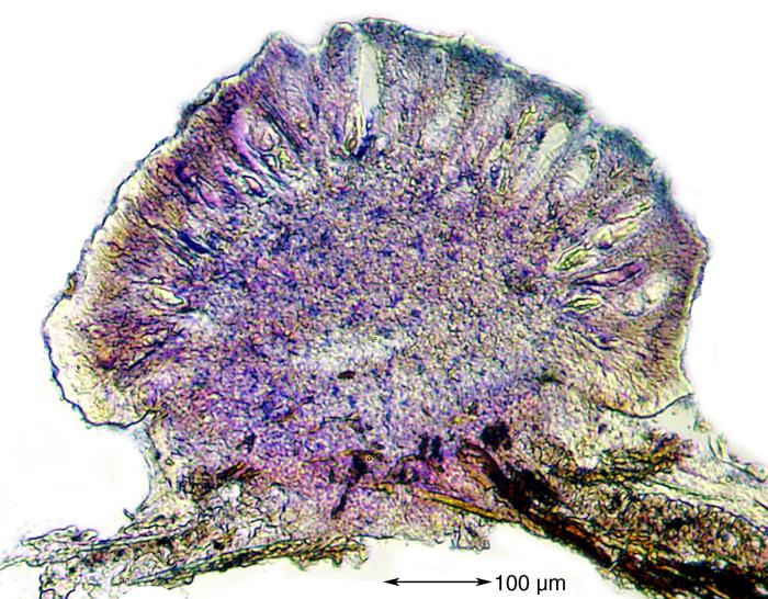 Mycoblastus affinis (Schaer.) T. Schauer, 1964