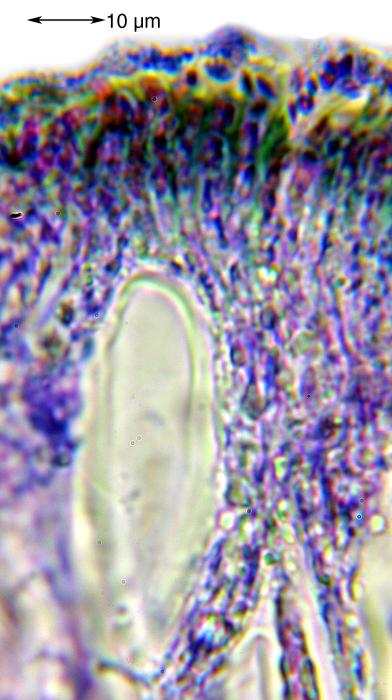 Mycoblastus affinis (Schaer.) T. Schauer, 1964
