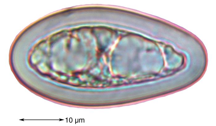 Mycoblastus affinis (Schaer.) T. Schauer, 1964