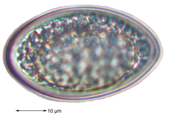 Mycoblastus affinis (Schaer.) T. Schauer, 1964