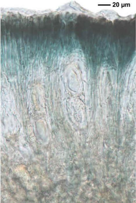 Mycoblastus affinis (Schaer.) T. Schauer, 1964